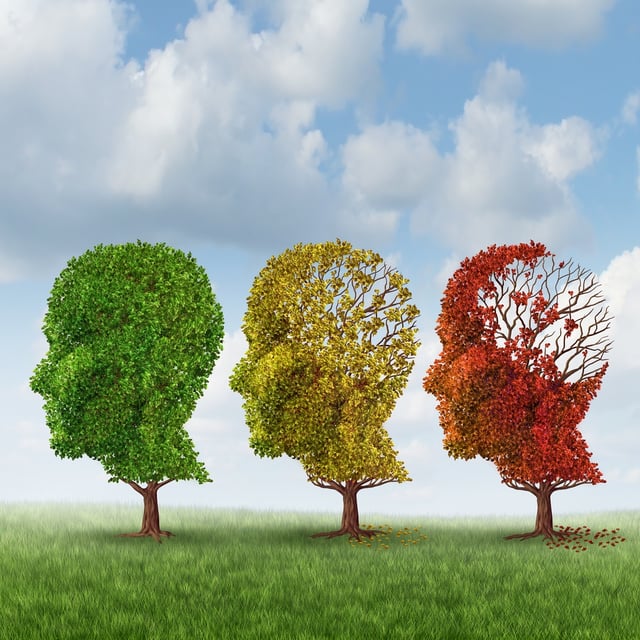 Alzheimer's brain image