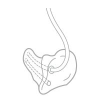 semiCanal.png