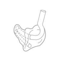 semiCanal.png
