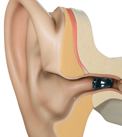 IIC_anatomy.png