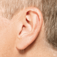 invisivle-in-the-ear-hearing-aid.jpg